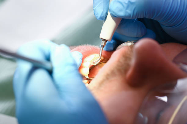Best Emergency Tooth Extraction  in Verandah, FL