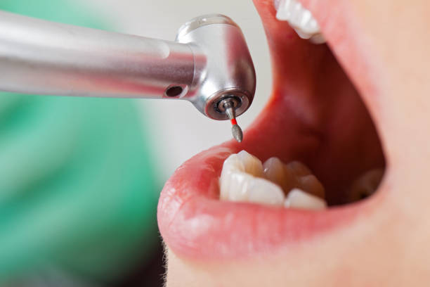 Best Tooth Pain Emergency Relief  in Verandah, FL
